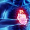 L'angine de poitrine est une douleur thoracique aiguë ou une gêne ressentie au niveau de la poitrine en raison d'une réduction de l'apport sanguin au cœur due à un rétrécissement des artères cardiaques.