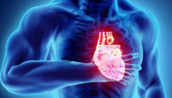 L'angine de poitrine est une douleur thoracique aiguë ou une gêne ressentie au niveau de la poitrine en raison d'une réduction de l'apport sanguin au cœur due à un rétrécissement des artères cardiaques.
