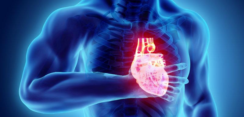 L'angine de poitrine est une douleur thoracique aiguë ou une gêne ressentie au niveau de la poitrine en raison d'une réduction de l'apport sanguin au cœur due à un rétrécissement des artères cardiaques.